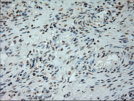 L1CAM Antibody - IHC of paraffin-embedded Ovary tissue using anti-L1CAM mouse monoclonal antibody. (Dilution 1:50).