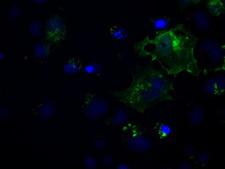 L1CAM Antibody - Anti-L1CAM mouse monoclonal antibody  immunofluorescent staining of COS7 cells transiently transfected by pCMV6-ENTRY L1CAM.