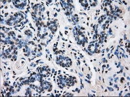 L1CAM Antibody - IHC of paraffin-embedded breast tissue using anti-L1CAM mouse monoclonal antibody. (Dilution 1:50).