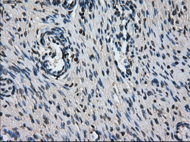 L1CAM Antibody - IHC of paraffin-embedded Ovary tissue using anti-L1CAMmouse monoclonal antibody. (Dilution 1:50).