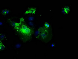 L1CAM Antibody - Anti-L1CAM mouse monoclonal antibody immunofluorescent staining of COS7 cells transiently transfected by pCMV6-ENTRY L1CAM.