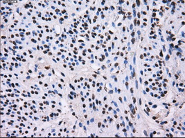 L1CAM Antibody - IHC of paraffin-embedded endometrium tissue using anti-L1CAMmouse monoclonal antibody. (Dilution 1:50).
