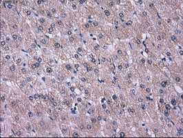 L1CAM Antibody - IHC of paraffin-embedded liver tissue using anti-L1CAM mouse monoclonal antibody. (Dilution 1:50).