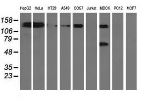 L1CAM Antibody - Western blot of extracts (35 ug) from 9 different cell lines by using anti-L1CAM monoclonal antibody.