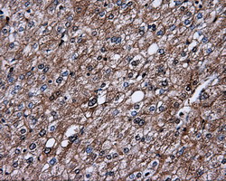 L1CAM Antibody - IHC of paraffin-embedded liver tissue using anti-L1CAM mouse monoclonal antibody. (Dilution 1:50).