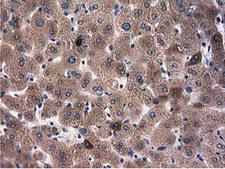 L1CAM Antibody - Immunohistochemical staining of paraffin-embedded Human liver tissue using anti-L1CAM mouse monoclonal antibody.