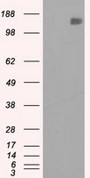 L1CAM Antibody - HEK293T cells were transfected with the pCMV6-ENTRY control (Left lane) or pCMV6-ENTRY L1CAM (Right lane) cDNA for 48 hrs and lysed. Equivalent amounts of cell lysates (5 ug per lane) were separated by SDS-PAGE and immunoblotted with anti-L1CAM.