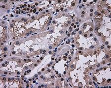 L1CAM Antibody - Immunohistochemical staining of paraffin-embedded Kidney tissue using anti-L1CAM mouse monoclonal antibody. (Dilution 1:50).