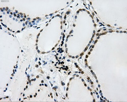 L1CAM Antibody - Immunohistochemical staining of paraffin-embedded thyroid tissue using anti-L1CAM mouse monoclonal antibody. (Dilution 1:50).