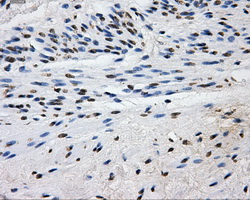 L1CAM Antibody - Immunohistochemical staining of paraffin-embedded endometrium tissue using anti-L1CAM mouse monoclonal antibody. (Dilution 1:50).