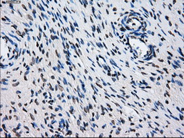 L1CAM Antibody - IHC of paraffin-embedded Ovary tissue using anti-L1CAM mouse monoclonal antibody. (Dilution 1:50).