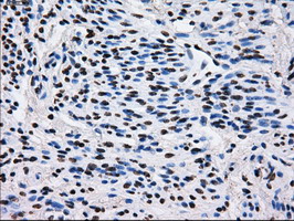 L1CAM Antibody - IHC of paraffin-embedded endometrium tissue using anti-L1CAM mouse monoclonal antibody. (Dilution 1:50).
