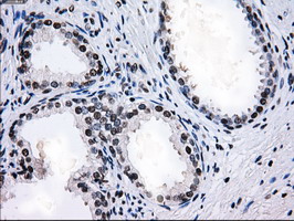 L1CAM Antibody - IHC of paraffin-embedded prostate tissue using anti-L1CAM mouse monoclonal antibody. (Dilution 1:50).