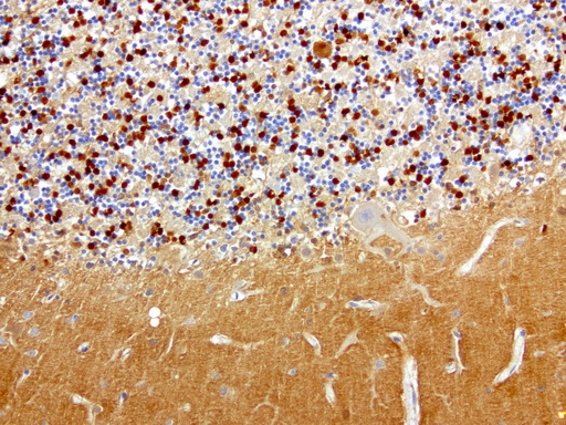 L1CAM Antibody - Immunohistochemical staining of paraffin-embedded human brain using anti-L1CAM clone UMAB47 mouse monoclonal antibody  at 1:200 with Polink2 Broad HRP DAB detection kit; heat-induced epitope retrieval with GBI ACCEL HIER buffer using pressure chamber for 3 minutes at 110C. Cytoplasmic and membraneous staining seen in staining in granular layer and the molecular layer.