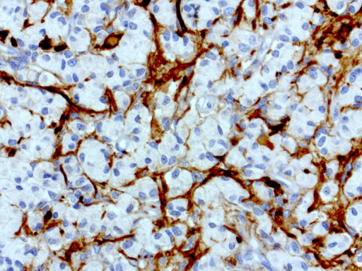 L1CAM Antibody - Immunohistochemical staining of paraffin-embedded human pituitary using anti-L1CAM clone UMAB47 mouse monoclonal antibody  at 1:200 with Polink2 Broad HRP DAB detection kit; heat-induced epitope retrieval with GBI ACCEL HIER buffer using pressure chamber for 3 minutes at 110C. Image shows only a subset of cells with positive cytoplasmic and membraneous stain.