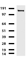 L1CAM Antibody - Western blot of cell lysates. (35ug) from HeLa. Diluation: 1:500