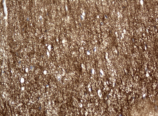 L1CAM Antibody - Immunohistochemical staining of paraffin-embedded Human embryonic brain cortex tissue using anti-L1CAM mouse monoclonal antibody.  heat-induced epitope retrieval by 10mM citric buffer, pH6.0, 120C for 3min)