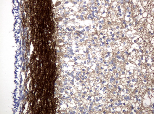 L1CAM Antibody - Immunohistochemical staining of paraffin-embedded Human embryonic cerebellum using anti-L1CAM mouse monoclonal antibody.  heat-induced epitope retrieval by 10mM citric buffer, pH6.0, 120C for 3min)