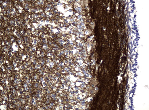 L1CAM Antibody - Immunohistochemical staining of paraffin-embedded Human embryonic cerebellum using anti-L1CAM mouse monoclonal antibody.  heat-induced epitope retrieval by 10mM citric buffer, pH6.0, 120C for 3min)