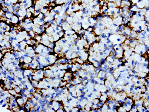 L1CAM Antibody - Immunohistochemical staining of paraffin-embedded human pituitary using anti-L1CAM clone UMAB48 mouse monoclonal antibody  at 1:200 with Polink2 Broad HRP DAB detection kit; heat-induced epitope retrieval with GBI ACCEL HIER buffer using pressure chamber for 3 minutes at 110C. Image shows only a subset of cells with positive cytoplasmic and membraneous stain.