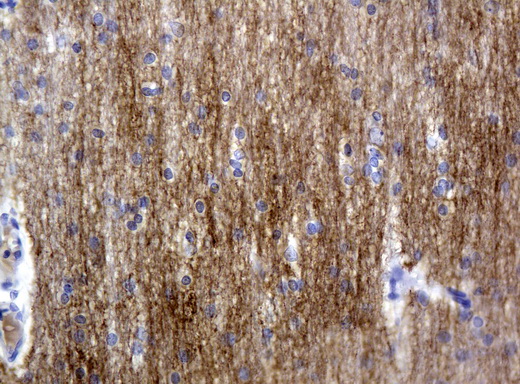 L1CAM Antibody - Immunohistochemical staining of paraffin-embedded Human adult brain tissue using anti-L1CAM mouse monoclonal antibody.  heat-induced epitope retrieval by 10mM citric buffer, pH6.0, 120C for 3min)