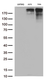 L1CAM Antibody - Western blot analysis of extracts. (35ug) from 3 cell line lysates by using anti-L1CAM monoclonal antibody. (1:500)