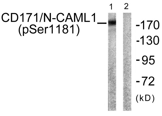 L1CAM Antibody - Western blot analysis of lysates from K562 cells, using CD171/N-CAML1 (Phospho-Ser1181) Antibody. The lane on the right is blocked with the phospho peptide.