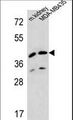 L2HGDH Antibody - L2HGDH Antibody western blot of MDA-MB435 cell line and mouse kidney tissue lysates (35 ug/lane). The L2HGDH antibody detected the L2HGDH protein (arrow).