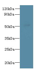 L2HGDH Antibody - Western blot. All lanes: L2HGDH antibody at 8 ug/ml+ K562 whole cell lysate Goat polyclonal to rabbit at 1:10000 dilution. Predicted band size: 50 kDa. Observed band size: 50 kDa.
