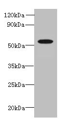 L2HGDH Antibody - Western blot All lanes: L2HGDH antibody at 8µg/ml + K562 whole cell lysate Secondary Goat polyclonal to rabbit IgG at 1/10000 dilution Predicted band size: 51, 49 kDa Observed band size: 51 kDa