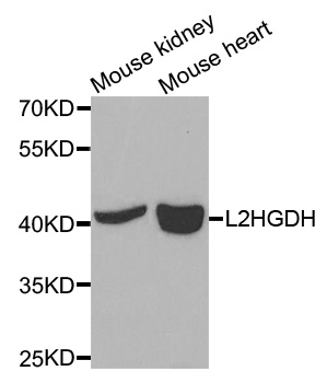 L2HGDH Antibody - Western blot analysis of extracts of various cells.