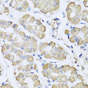 L2HGDH Antibody - Immunohistochemistry of paraffin-embedded human stomach tissue.