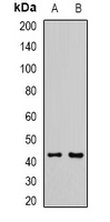 L2HGDH Antibody - Western blot analysis of L2HGDH expression in mouse kidney (A); mouse heart (B) whole cell lysates.
