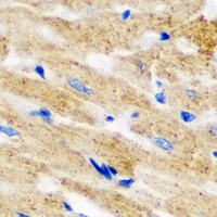 L2HGDH Antibody - Immunohistochemical analysis of L2HGDH staining in mouse heart formalin fixed paraffin embedded tissue section. The section was pre-treated using heat mediated antigen retrieval with sodium citrate buffer (pH 6.0). The section was then incubated with the antibody at room temperature and detected using an HRP conjugated compact polymer system. DAB was used as the chromogen. The section was then counterstained with hematoxylin and mounted with DPX.