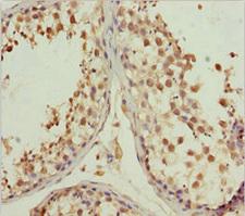 L2HGDH Antibody - Immunohistochemistry of paraffin-embedded human testis tissue at dilution 1:100