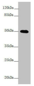 L2HGDH Antibody - Western blot All Lanes:L2HGDH antibody at 4.43 ug/ml +Mouse heart tissue Secondary Goat polyclonal to rabbit IgG at 1/10000 dilution Predicted band size: 51,49 kDa Observed band size: 50 kDa