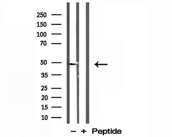 L2HGDH Antibody - Western blot analysis of extracts of SGC-7901 cells using L2HGDH antibody.