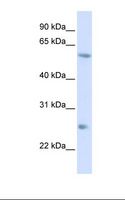 L3 / LASS2 Antibody - HepG2 cell lysate. Antibody concentration: 1.0 ug/ml. Gel concentration: 12%.  This image was taken for the unconjugated form of this product. Other forms have not been tested.