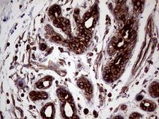 L3 / LASS2 Antibody - Immunohistochemical staining of paraffin-embedded Human breast tissue within the normal limits using anti-CERS2 mouse monoclonal antibody. (Heat-induced epitope retrieval by 1mM EDTA in 10mM Tris buffer. (pH8.5) at 120°C for 3 min. (1:1000)