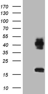 L3 / LASS2 Antibody - HEK293T cells were transfected with the pCMV6-ENTRY control. (Left lane) or pCMV6-ENTRY CERS2. (Right lane) cDNA for 48 hrs and lysed. Equivalent amounts of cell lysates. (5 ug per lane) were separated by SDS-PAGE and immunoblotted with anti-CERS2. (1:2000)