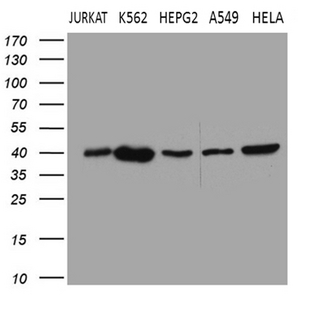 L3 / LASS2 Antibody - Western blot analysis of extracts. (35ug) from 5 different cell lines by using anti-CERS2 monoclonal antibody. (1:500)