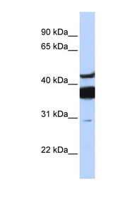 L3 / LASS2 Antibody - LASS2 antibody Western blot of Fetal Brain lysate. This image was taken for the unconjugated form of this product. Other forms have not been tested.