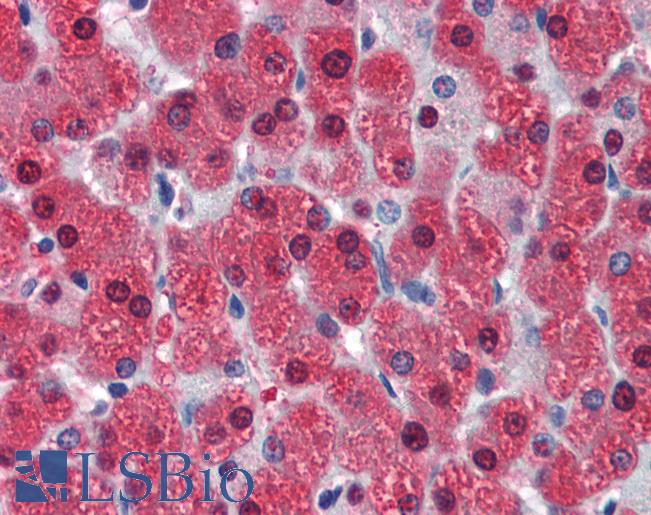L3 / LASS2 Antibody - Anti-LASS2 antibody IHC of human liver. Immunohistochemistry of formalin-fixed, paraffin-embedded tissue after heat-induced antigen retrieval. Antibody concentration 5 ug/ml.  This image was taken for the unconjugated form of this product. Other forms have not been tested.