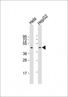 L3 / LASS2 Antibody - All lanes: Anti-CERS2 Antibody (Center) at 1:2000 dilution Lane 1: Hela whole cell lysate Lane 2: HepG2 whole cell lysate Lysates/proteins at 20 µg per lane. Secondary Goat Anti-Rabbit IgG, (H+L), Peroxidase conjugated at 1/10000 dilution. Predicted band size: 45 kDa Blocking/Dilution buffer: 5% NFDM/TBST.