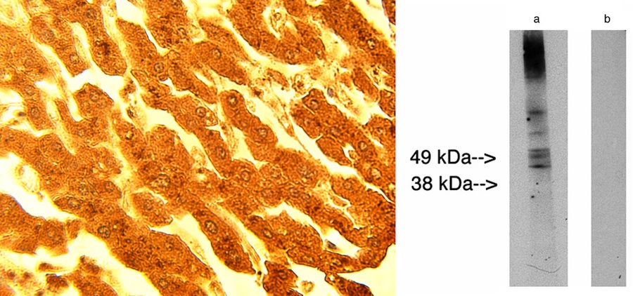 L3 / LASS2 Antibody - Left: IHC of normal human liver tissue using Lass2 antibody at 15 ug/ml. Right: Western blot of LAG1 longevity assurance homolog 2 (Lass2) at 10 ug/ml on human placenta lysate 14 ug/lane. Lane A] antibody alone, Lane B] conjugate alone. Visualized using Pierce West Femto substrate system. Anti Rabbit secondary used at 1:10K dilution. Exposure for 5 minutes