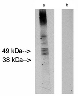 L3 / LASS2 Antibody - Western blot of LAG1 longevity assurance homolog 2 at 10 ug/ml on human placenta lysate 14 ug/lane. Lane A] antibody alone, Lane B] conjugate alone. Visualized using Pierce West Femto substrate system. Anti Rabbit secondary used at 1:10K dilution. Exposure for 5 minutes