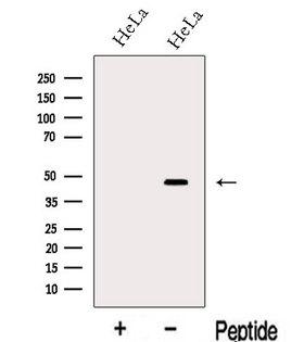 L3 / LASS2 Antibody - Western blot analysis of extracts of HeLa cells using LASS2 antibody. The lane on the left was treated with blocking peptide.