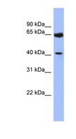 L3 / LASS2 Antibody - LASS2 antibody Western blot of Fetal Kidney lysate. This image was taken for the unconjugated form of this product. Other forms have not been tested.
