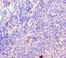 L35A / RPL35A Antibody - Immunohistochemistry of paraffin-embedded human lymphoid tissue using RPL35A Antibody at dilution of 1:100