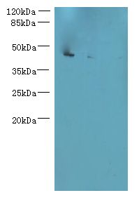 L3HYPDH / C14orf149 Antibody - Western blot. All lanes: L3HYPDH antibody at 8 ug/ml. Lane 1: HepG-2 whole cell lysate. Lane 2: A549 whole cell lysate. Lane 3: Mouse kidney tissue. Secondary Goat polyclonal to Rabbit IgG at 1:10000 dilution. Predicted band size: 38 kDa. Observed band size: 38 kDa.